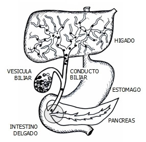Cálculos Biliares alojados